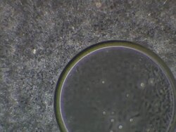 Human sperm, masses swimming, tilt down to sperm all around egg-like sphere Stock Footage