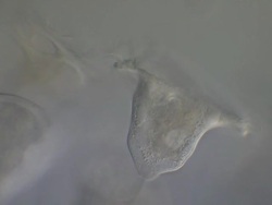 Vorticella sp. filter feeding: inverted bell-shaped ciliates, placed among the peritrichs. Each cell has a separate stalk anchored onto the substrate, which contains a contractile fibril called a myoneme. Stock Footage