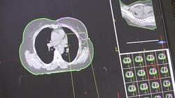 CLEAN : Modern life bad habits: Africa faces deadly new illnesses News Clip