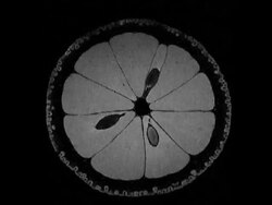 Lemon MRI - PAL Stock Footage