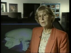 USA: NASA TO SHARE MEDICINE TECHNOLOGY WITH DEPARTMENT OF HEALTH News Clip