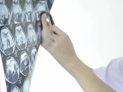 Doctor reading MRI film result Stock Footage