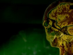 Body part, medicine, pelvis Stock Footage