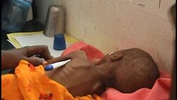 UN REPORT SAYS AFRICA REMAINS MOST FOOD INSECURE AREA IN THE WORLD News Clip