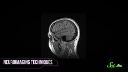 Do I Only Use 10% of My Brain? Instructional Video