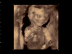 Foetus moving in womb, 4D ultrasound.. Stock Footage