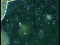 CU microscopic view of ciliate protozoans in freshwater farmyard pool sample Stock Footage