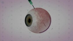 Animation shows how new gene therapy restores sight in the blind News Clip