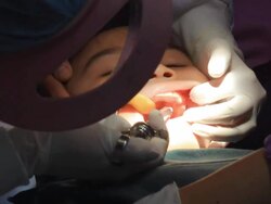 Little girl in dentist office Stock Footage