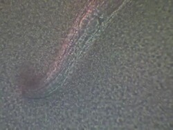 Caenorhabditis elegans (C.elegans) feeding on lawn of bacteria ( Escherischia coli OP50 ) Stock Footage