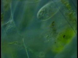 Microscopic view of Ciliates and filamentous algae in background Stock Footage
