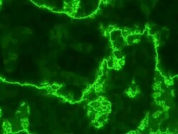 Caustic (Loopabe) Stock Footage