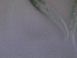 Caenorhabditis elegans (C.elegans) feeding on lawn of bacteria ( Escherischia coli OP50 ) Stock Footage