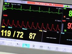 Vital signs monitor Stock Footage