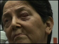 A rare condition that destroys cells on the eye's surface left Kay Thornton blind for nearly a decade.  Earlier this month, doctors used a tooth and part of the lining from her cheek to create a 'window' that allows light into the eye. Instructional Video