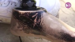 Empowered Teen Proud of Prosthetic Leg | SHAKE MY BEAUTY Instructional Video