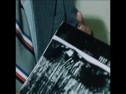 SYND 24 4 75 DR. JOLING REVIEWS THE EVIDENCE ON SENATOR KENNEDY ASSASSINATION News Clip