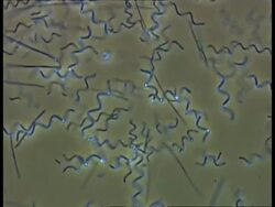 Spirochaeta bacteria and other bacteria moving in pond water. Phase Contrast; good motility Stock Footage