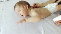 Mother taking care of baby with chicken pox Stock Footage