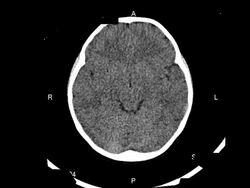 CAT and MRI Scan Stock Footage