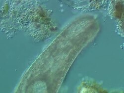 Ciliate unidentified Stock Footage