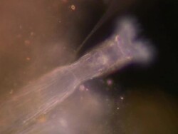 Philodina rotifer creating vortex current with beating cilia, for ingesting small microorganisms such as bacteria and algae. Stock Footage