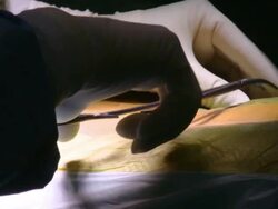  CU Surgeon holding tool and measuring / Cagliari, Sardinia, Italy Stock Footage