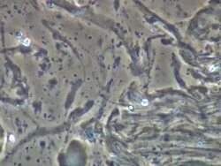 Human sperm swept along in ejaculate Stock Footage