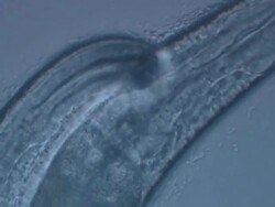 Caenorhabditis elegans (C.elegans) feeding on bacteria (E.coli OP50), visible in water film next to body. Olympus BH-2 40x S-Plan objective, 2.5x NFK photoeyepiece, no condenser. Sony PMW-EX3 FullHD video camera. Stock Footage