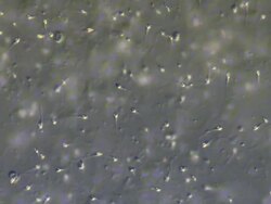 Human sperm, medium lots sperm swimming around, shows shape of heads Stock Footage