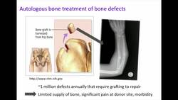 Molly Stevens: A new way to grow bone Instructional Video