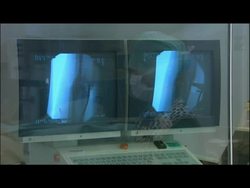 Stem Cells - Procedure in Process News Clip