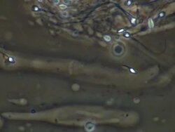 Human sperm, single sperm swimming strongly, track along with sperm Stock Footage