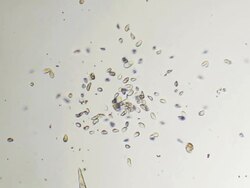 Colony of microorganisms Stock Footage