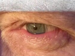 Color Condensation Stock Footage