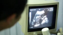 Prenatul ultrasound and fetal monitoring Stock Footage
