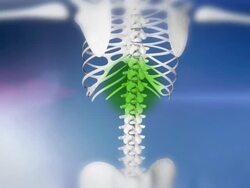 HD: Healing Of A Backache Stock Footage