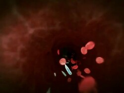 Close Up push-in - A mosquito bite infects a bloodstream in a computer-generated animation. Stock Footage