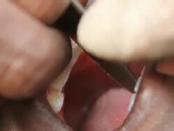 Man cutting boy's tooth during ritual Stock Footage