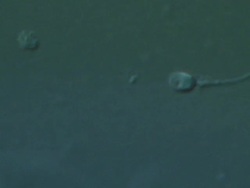 Single Human sperm swimming, big close up, Interference contrast Stock Footage