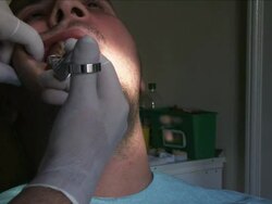At The Dentist Stock Footage