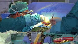 Assistant sterilizes forceps and gives it to surgeon during operation Stock Footage