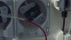 Working artificial kidney Stock Footage