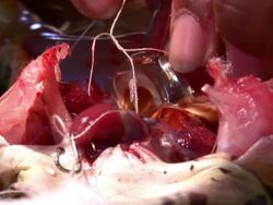 Frog heart Stock Footage