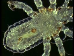 BCU microscopic view of Head louse with new skin or moulting, United Kingdom Stock Footage