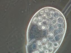 Phase Contrast cinemicrography of Ciliate feeding on bacteria Stock Footage