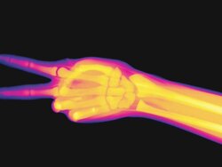 X-ray of a hand performing the actions of rock paper scissors Stock Footage