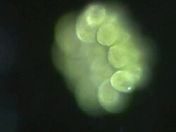 Gonium swimming in pond water. Gonium consist of square, flat, four or sixteen-celled colonies, up to 100 microns across and common in puddles, ponds, lakes and slow rivers. Stock Footage