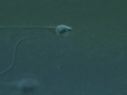 Single Human sperm swimming, big close up, Interference contrast Stock Footage