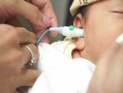 Newborn Infant Hearing Screening Stock Footage